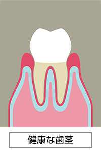 健康な歯茎